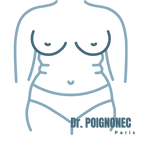 Mini-plastie abdominale 1