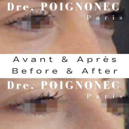 Médecine préventive esthétique visage sans chirurgie 2