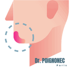 Chirurgie esthétique menton liposuccion menton ou génioplastie 4