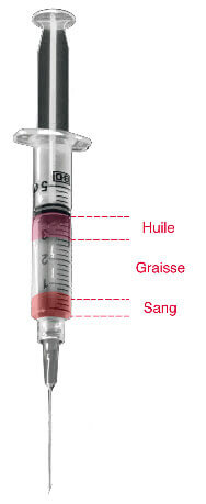 Lipofilling visage - Lipostructure 4