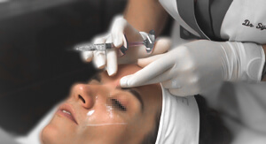 Hyaluronic acid injection 5